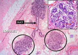 Female Breast Tissue