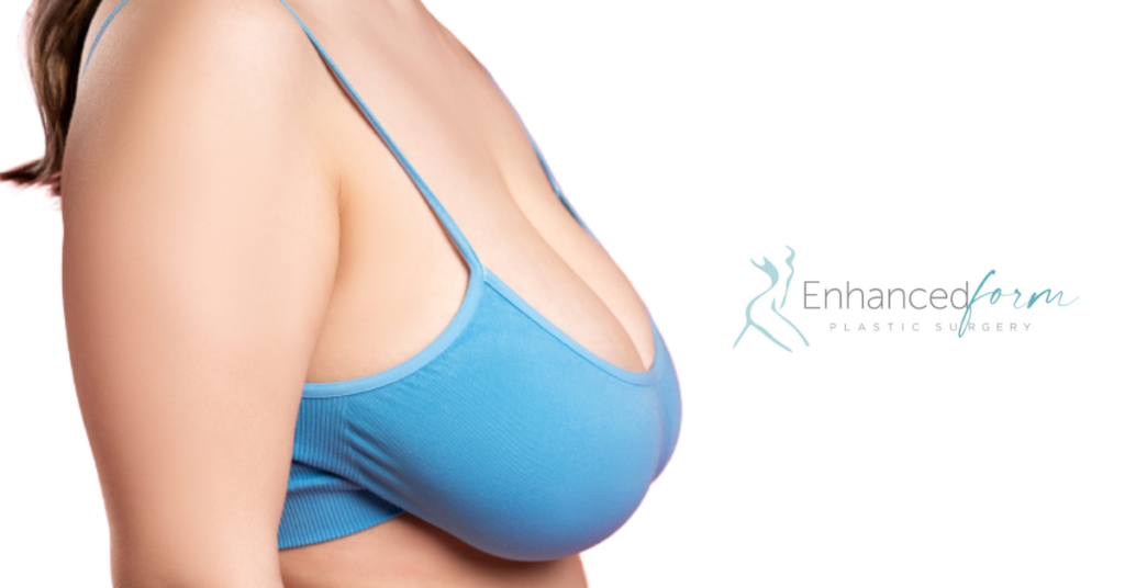 Breast Lift at Enhanced Form - Blog Photo