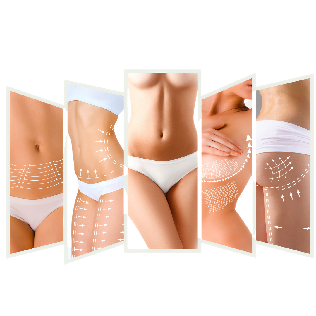Body Contouring Mommy MakeOver in Chicago